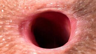 SCHOOLGIRL WASHED ASSHOLE PROPERLY TO OPEN IT FOR THE DOCTOR - porn video